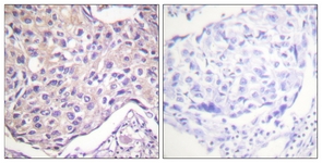 		Immunohistochemical