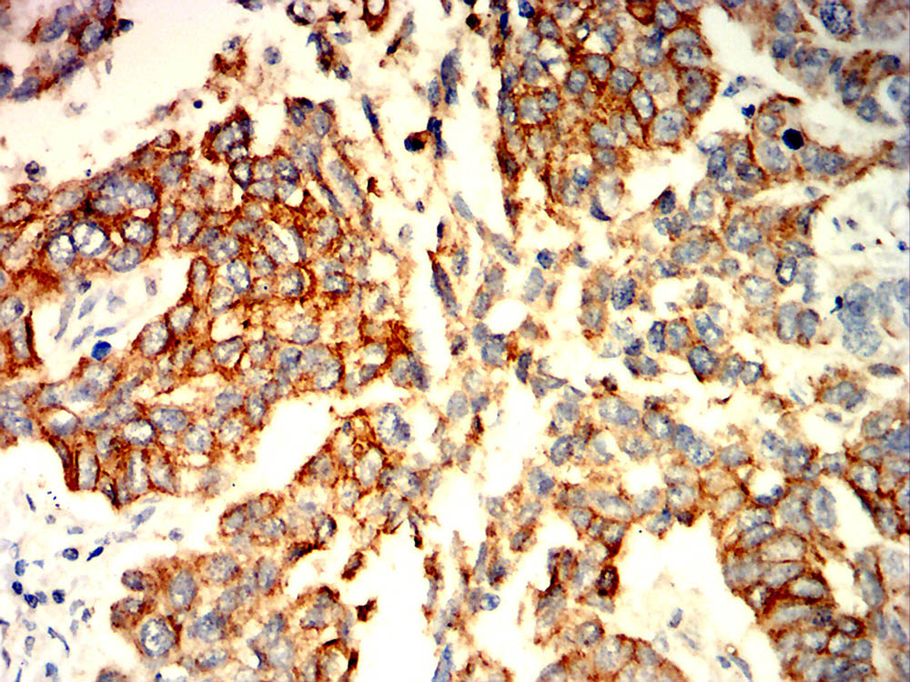 		IHC