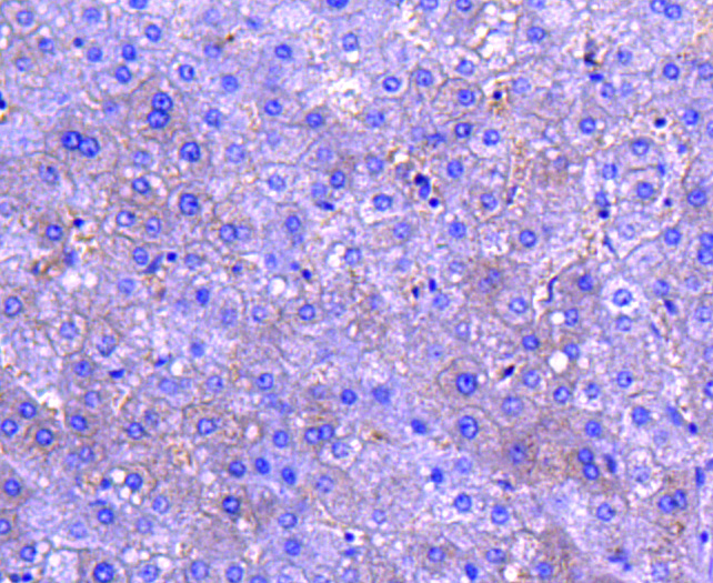 M-CSF Recombinant Rabbit Monoclonal Antibody - Omnimabs