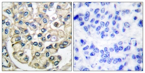 		Immunohistochemical