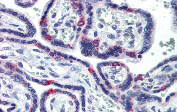 		Immunohistochemistry
