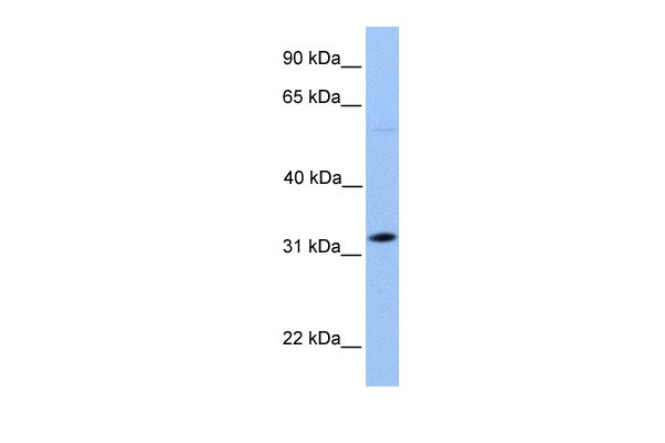 		Western blot
