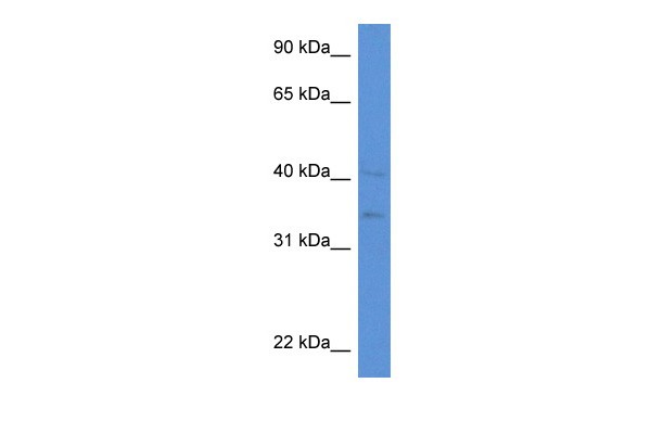 		Western blot