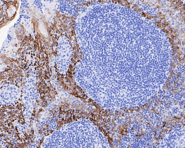 IHC