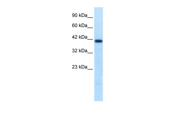 		Western blot