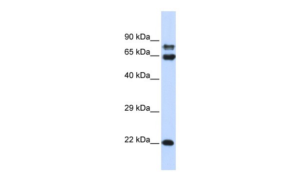 		Western blot