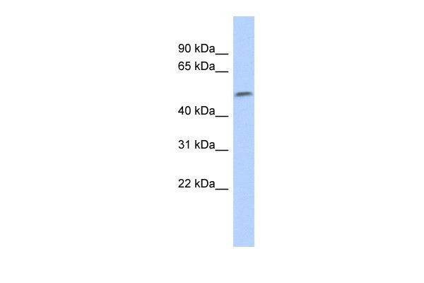 Western blot