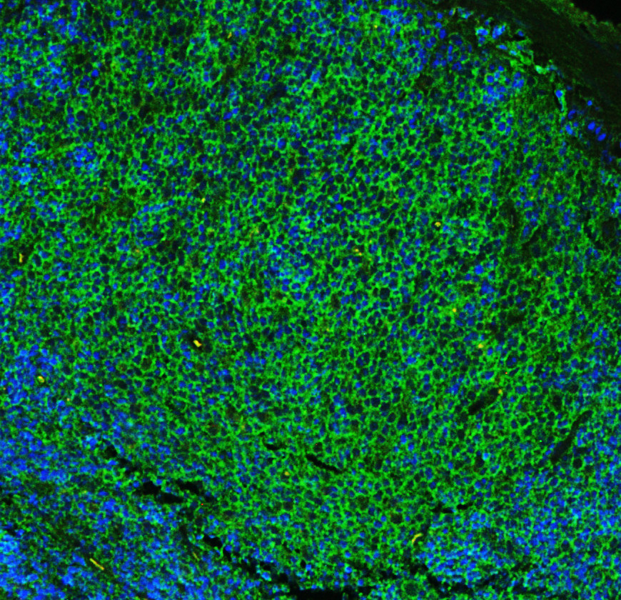 Fcer2 Anti-CD23/FCER2 Antibody - Omnimabs