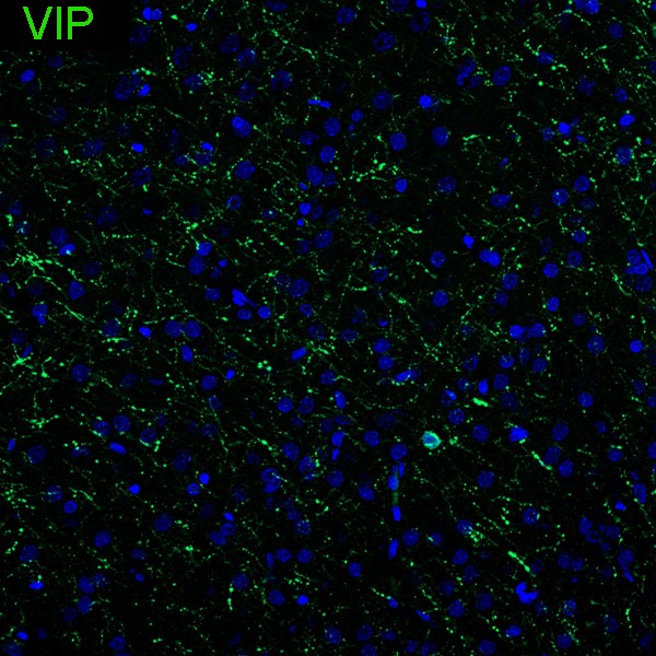 Vip Rabbit VIP Recombinant Rabbit Monoclonal Antibody - Omnimabs