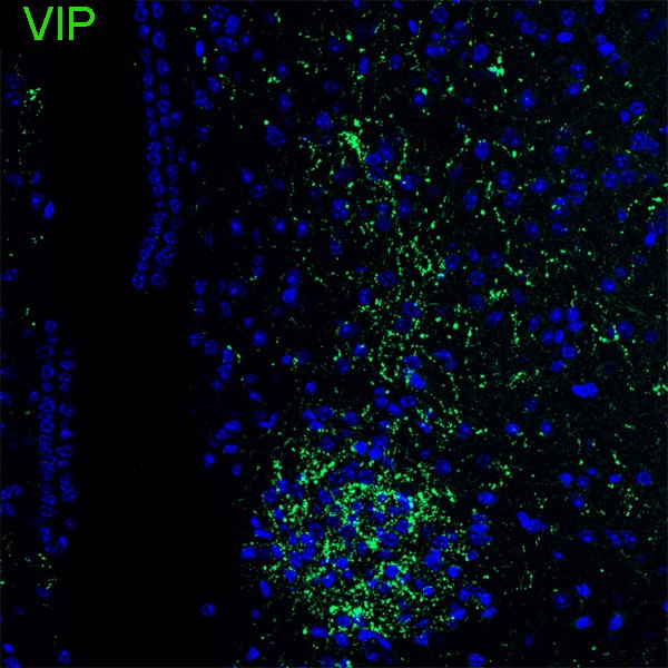 VIP Recombinant Rabbit Monoclonal Antibody - Omnimabs