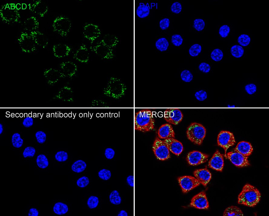 ABCD1 / ALD Recombinant Rabbit Monoclonal Antibody - Omnimabs