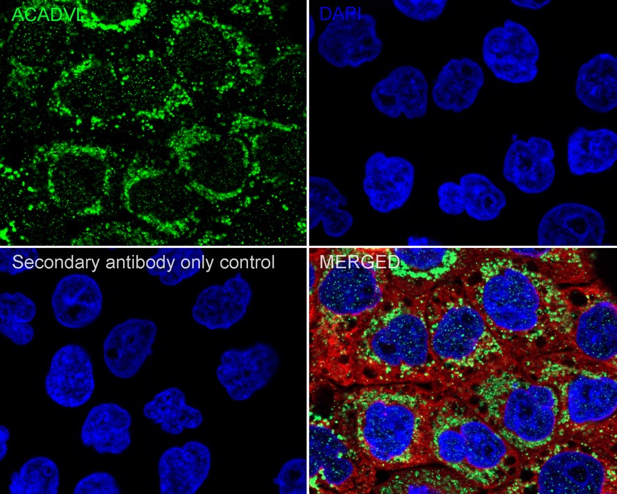 ACADVL / VLCAD Recombinant Rabbit Monoclonal Antibody - Omnimabs