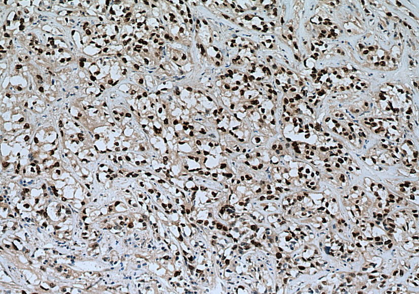 IHC