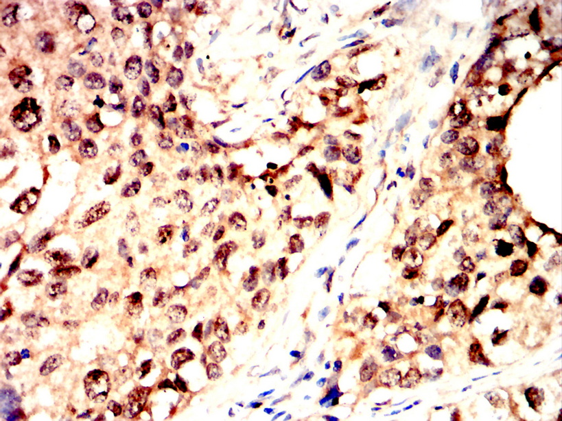 IHC