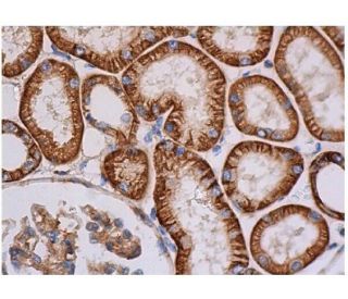 IHC
