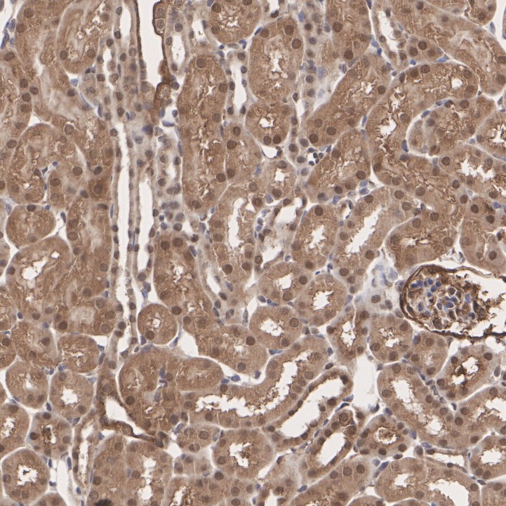 IHC