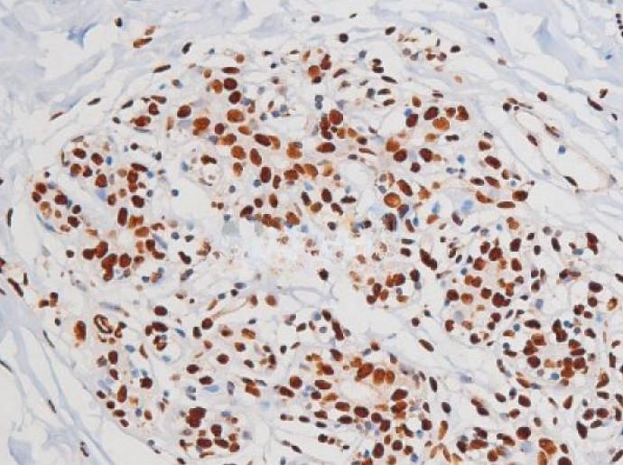 IHC