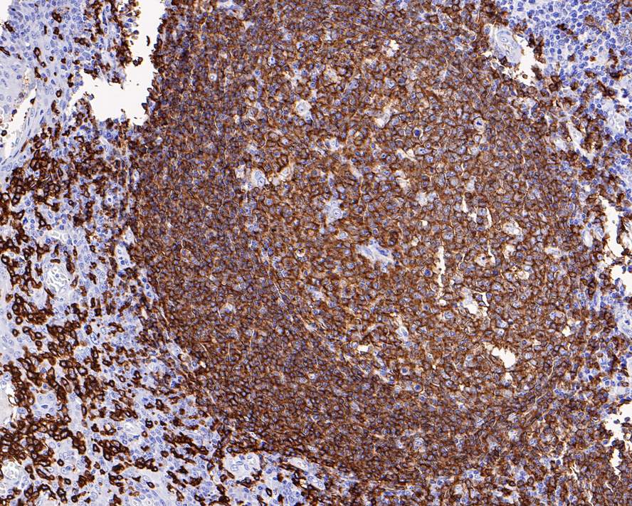 IHC