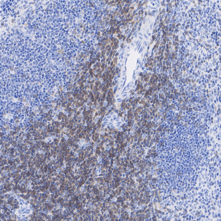 Lck Recombinant Rabbit Monoclonal Antibody - Omnimabs