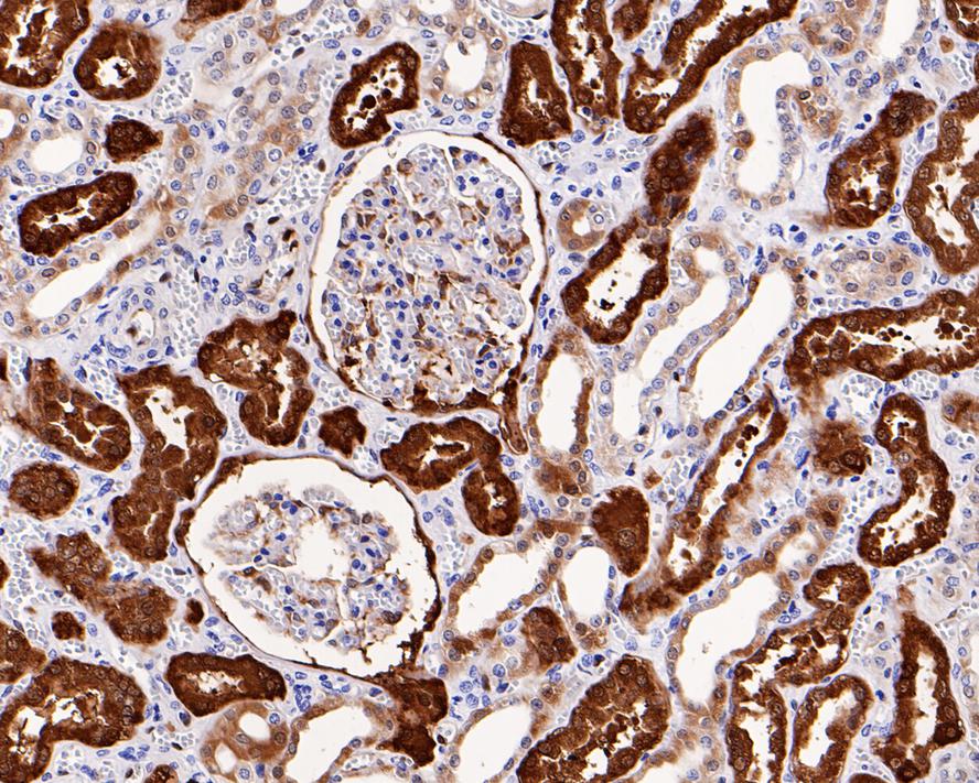 IHC
