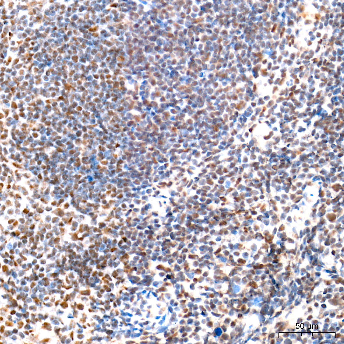 IHC