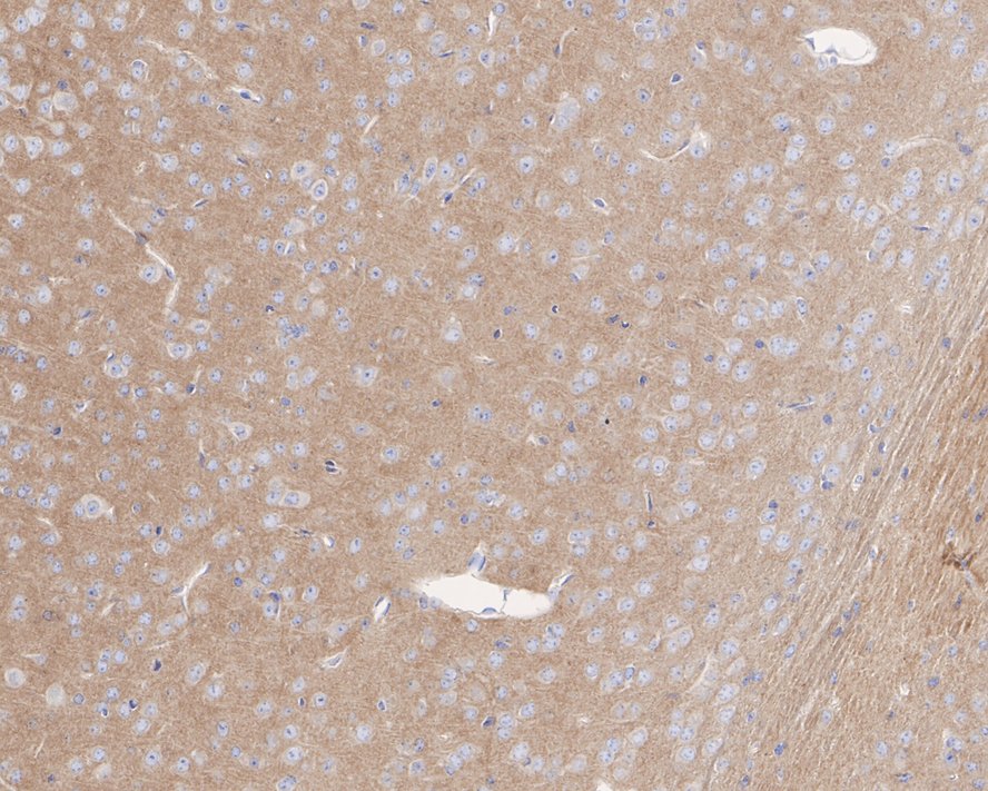 IHC