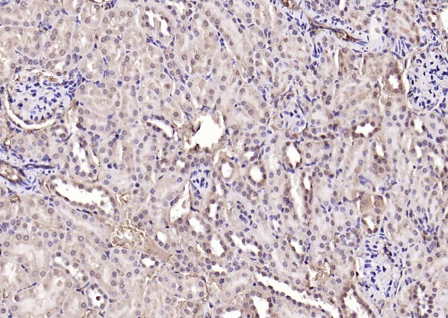 IHC