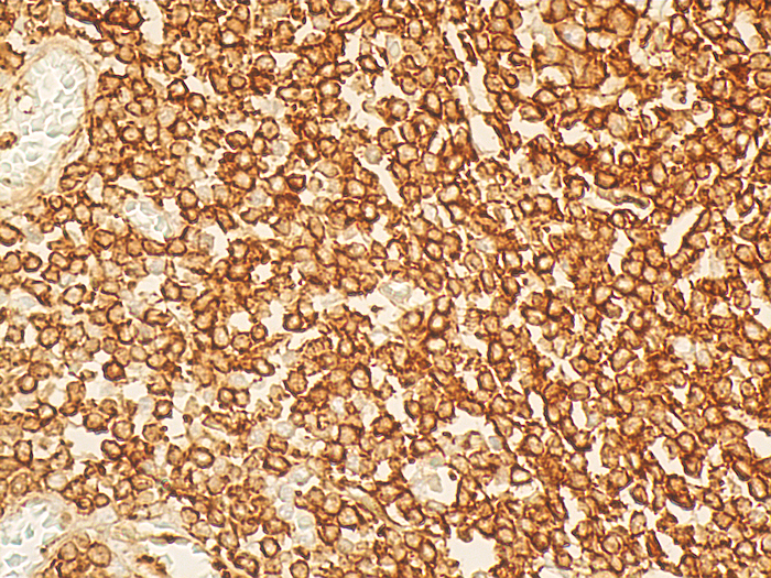 IHC