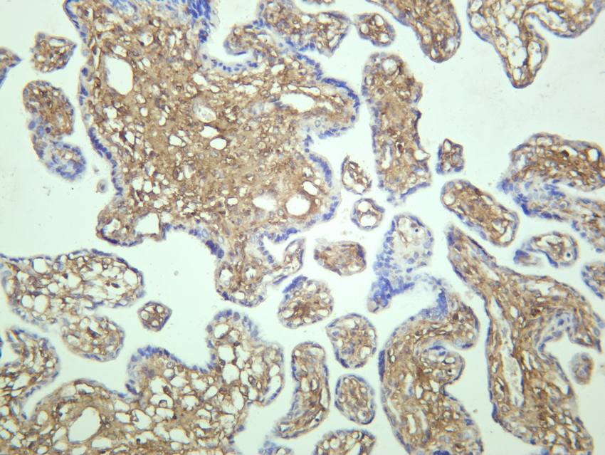 IHC