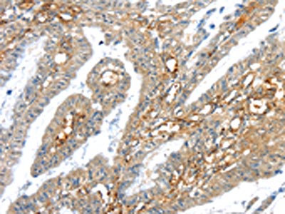 IHC