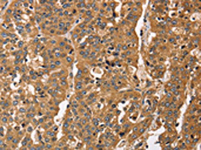 IHC