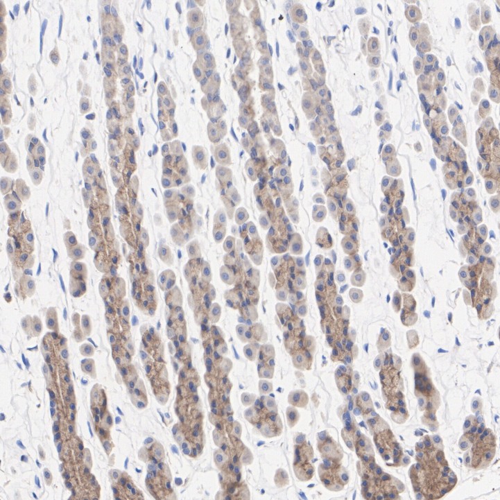 IHC