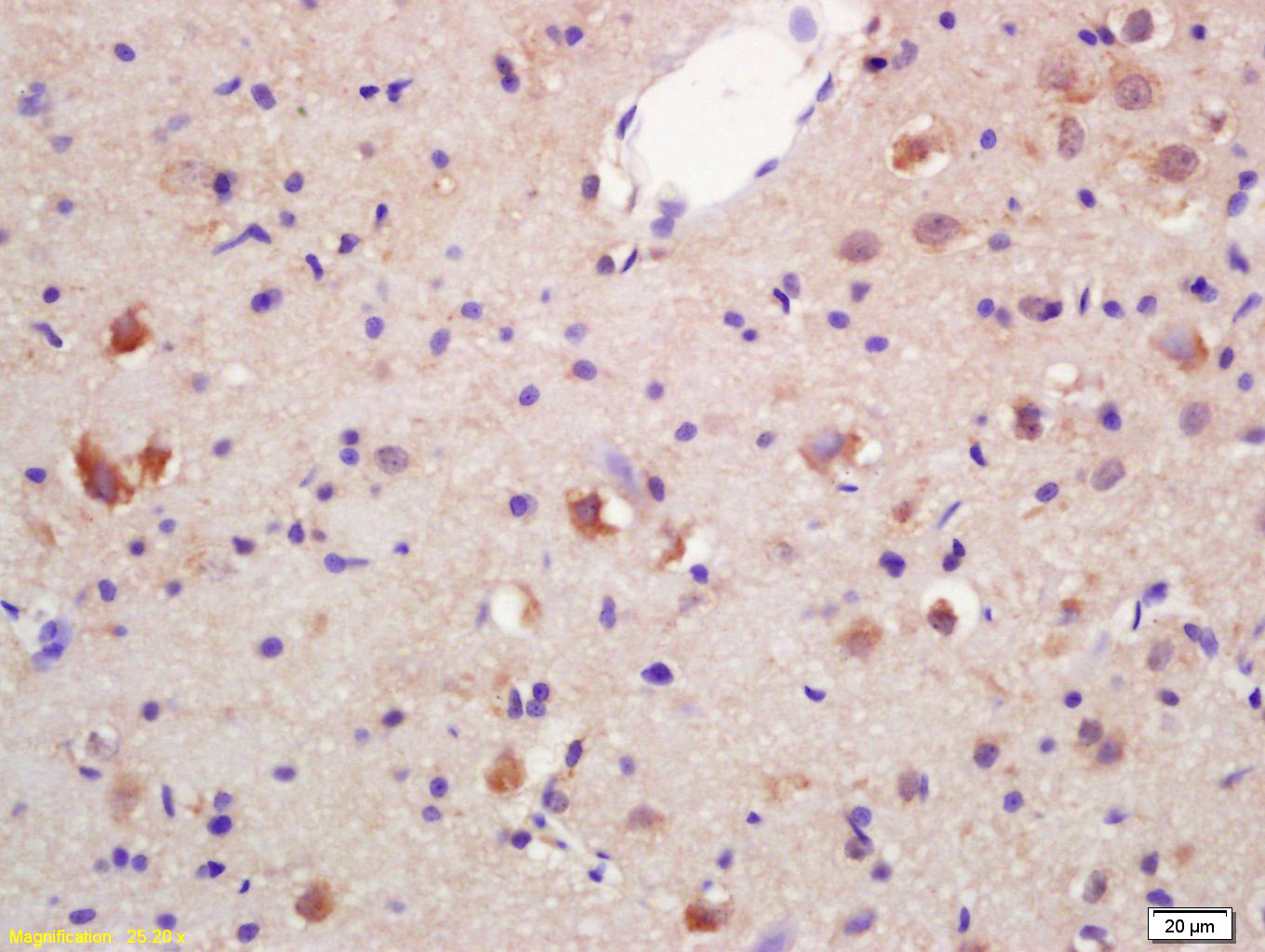 IHC