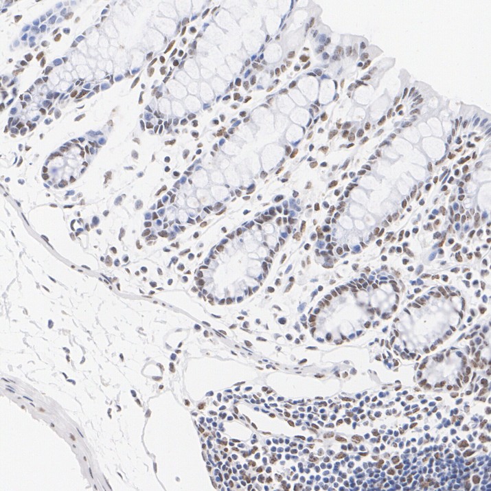 IHC