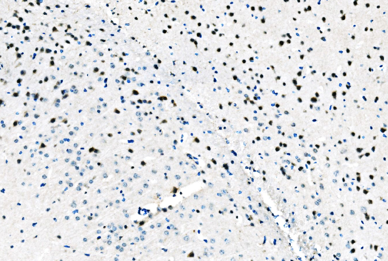 IHC