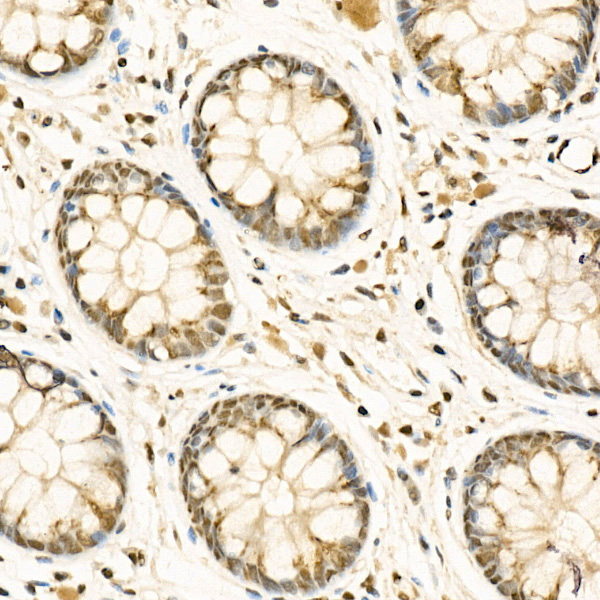 IHC