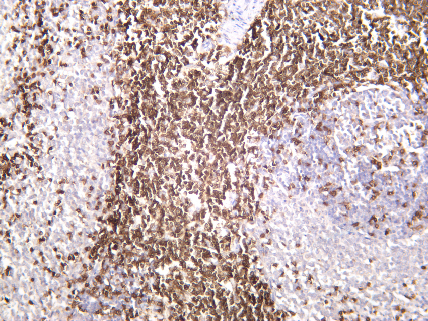 IHC
