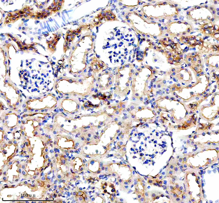 IHC