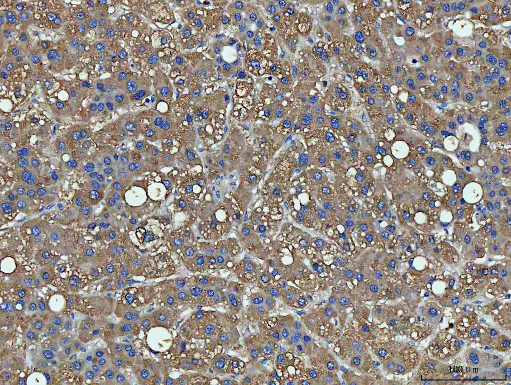 IHC