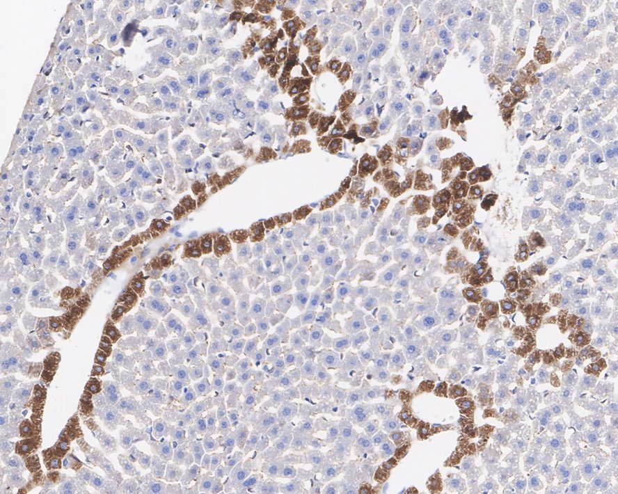 IHC
