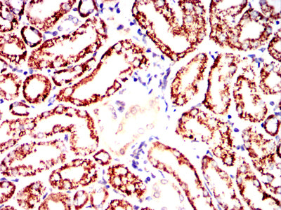 IHC