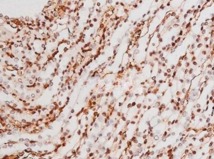 IHC
