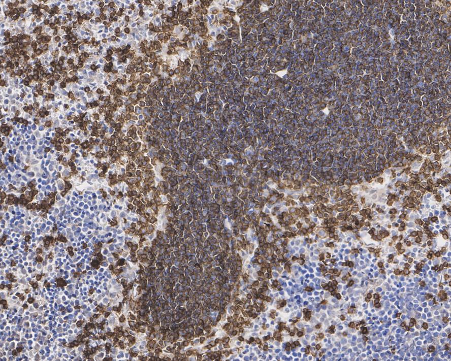 IHC
