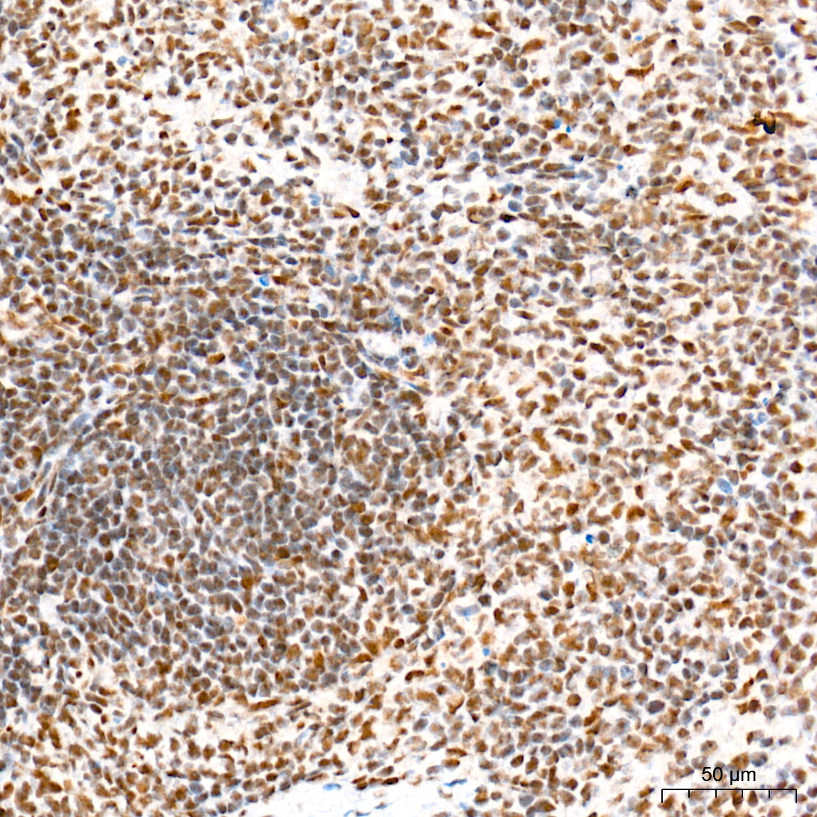 IHC