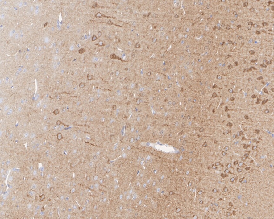 IHC