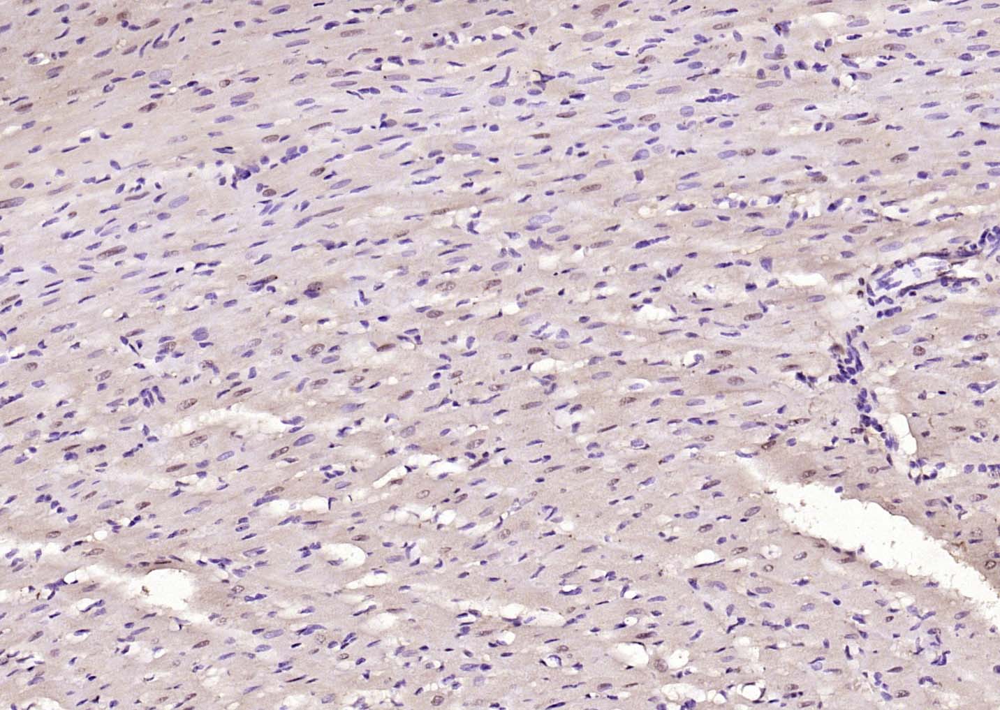 IHC
