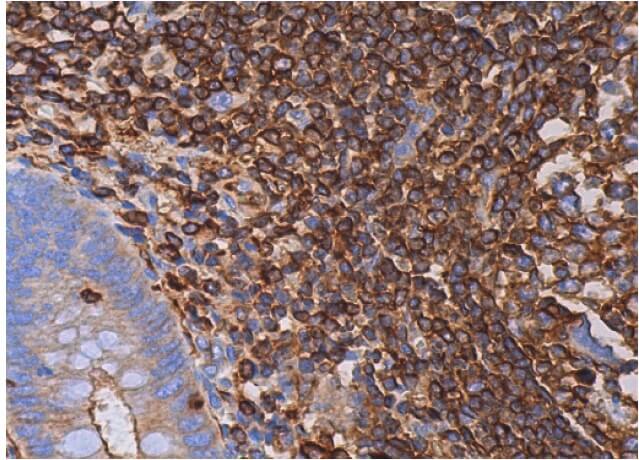 IHC