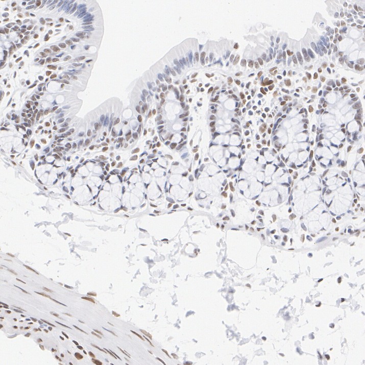 IHC