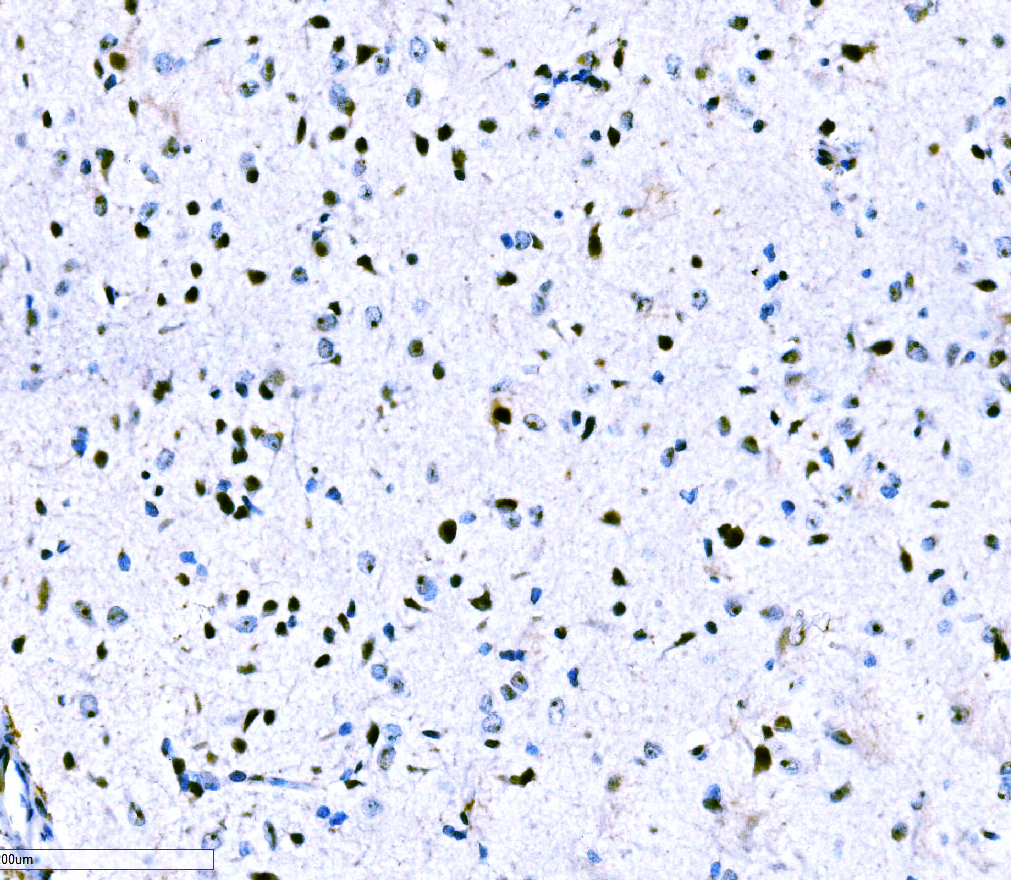 IHC