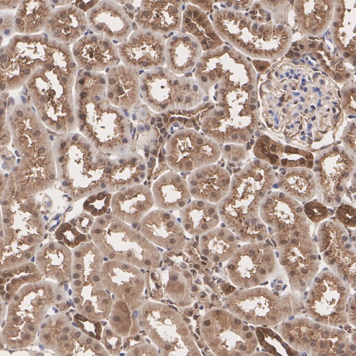 IHC